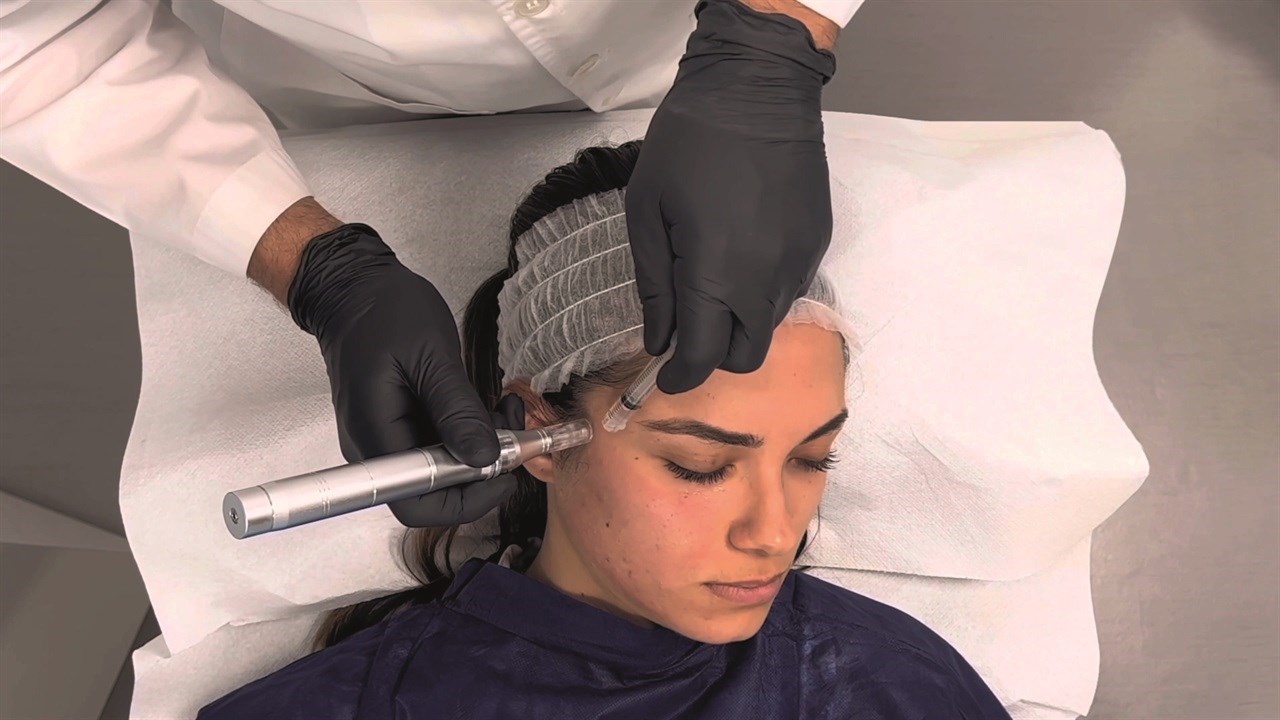 VM Corporation har et bredt program av behandlingsprodukter basert på syntetiske eksosomer, fra V Carbon System, en antiaging peeling med aktivt karbon, til Exocell Mask og V Bianco System for behandling av pigmentflekker. Foto: UpNorth